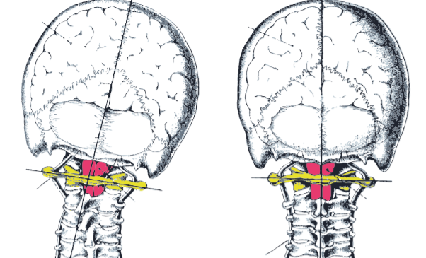 The Brain and Nervous System How It Controls Your Health